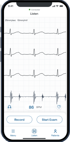 Eko_App_Listen_Screen_with_3_Lead_ECG.jpg