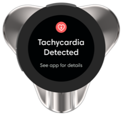 CORE_500_Analysis_Tachycardia.png