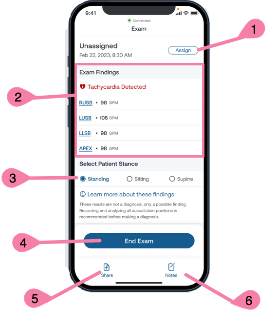 Eko_App_Cardiac_Exam_Summary_with_numbers.png