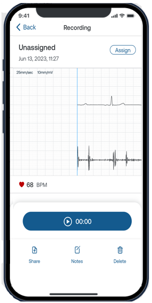 Eko_App_Patients_Unassigned_recording_copy.png