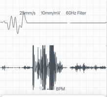 Eko_App_Noisy_Signal_DUO.png